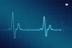 Como escolher um eletrocardiograma Descubra aqui!